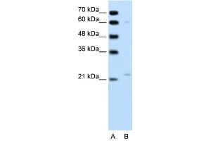 RGS4 antibody used at 1 ug/ml to detect target protein. (RGS4 抗体  (C-Term))