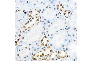 Immunohistochemistry of paraffin-embedded rat kidney using NR5 Rabbit pAb (ABIN6127421, ABIN6144833, ABIN6144835 and ABIN6221444) at dilution of 1:100 (40x lens). (NR5A2 + LRH1 抗体  (AA 206-495))
