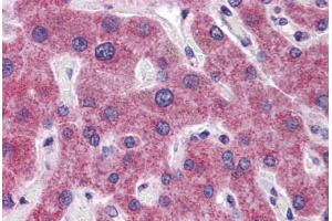 Human Liver: Formalin-Fixed, Paraffin-Embedded (FFPE) (RHBG 抗体  (AA 362-411))