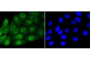HepG2 cells were stained with Smad5(S463/465) (1B8) Monoclonal Antibody  at [1:200] incubated overnight at 4C, followed by secondary antibody incubation, DAPI staining of the nuclei and detection. (SMAD5 抗体  (pSer463, pSer465))