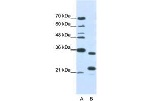 Western Blotting (WB) image for anti-AlkB, Alkylation Repair Homolog 8 (ALKBH8) antibody (ABIN2462330) (ALKBH8 抗体)