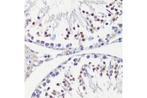 Immunohistochemistry of paraffin-embedded rat testis using HFM1 antibody (ABIN6133318, ABIN6141741, ABIN6141743 and ABIN6224711) at dilution of 1:100 (40x lens). (HFM1 抗体  (AA 1-240))