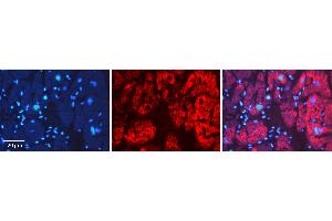 Rabbit Anti-AIFM1 Antibody   Formalin Fixed Paraffin Embedded Tissue: Human heart Tissue Observed Staining: Cytoplasmic, nucleus Primary Antibody Concentration: 1:100 Other Working Concentrations: 1:600 Secondary Antibody: Donkey anti-Rabbit-Cy3 Secondary Antibody Concentration: 1:200 Magnification: 20X Exposure Time: 0.