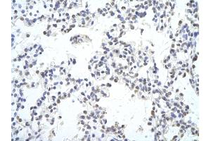 Rabbit Anti-MAF Antibody Catalog Number: ARP38608_P050  Paraffin Embedded Tissue: Human Lung cell  Cellular Data: Epithelial cells of renal tubule Antibody Concentration:  4. (MAF 抗体  (C-Term))