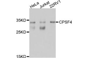 Western blot analysis of extracts of various cell lines, using CPSF4 antibody (ABIN5997508) at 1/1000 dilution. (CPSF4 抗体)