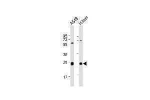 All lanes : Anti-TRH Antibody (C-Term) at 1:2000 dilution Lane 1: A549 whole cell lysate Lane 2: human liver lysate Lysates/proteins at 20 μg per lane. (TRH 抗体  (AA 157-191))