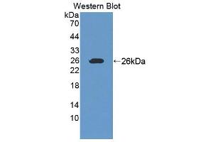 Western blot analysis of the recombinant protein. (Ninein 抗体  (AA 1-153))