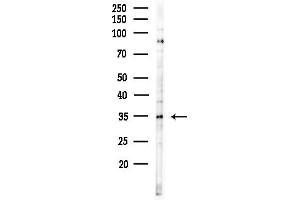 Western blot analysis of lysates from COLO205 cells(UV,30 min treatment), using Zn Antibody at 1/1000 dilution.
