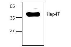 Image no. 1 for anti-Serpin Family H Member 1 (SERPINH1) antibody (ABIN127161) (SERPINH1 抗体)