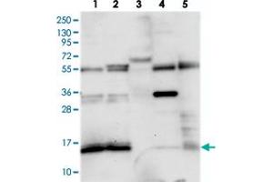 Western blot analysis of Lane 1: RT-4, Lane 2: U-251 MG, Lane 3: Human Plasma, Lane 4: Liver, Lane 5: Tonsil with FAM103A1 polyclonal antibody  at 1:250-1:500 dilution. (FAM103A1 抗体)