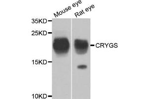 Western blot analysis of extracts of mouse eye and rat eye, using CRYGS antibody. (CRYGS 抗体)