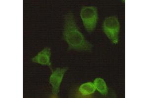 Immunocytochemistry staining of Hela using Eg5 mouse mAb (1:200). (KIF11 抗体)