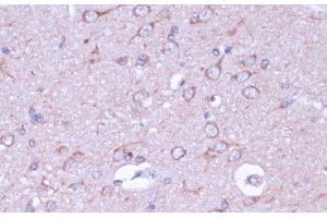 Immunohistochemistry of paraffin-embedded Rat brain using PRKACB Polyclonal Antibody at dilution of 1:100 (40x lens). (PRKACB 抗体)