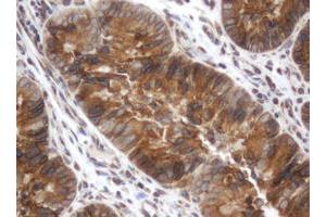 Image no. 3 for anti-Signal Recognition Particle Receptor, B Subunit (SRPRB) antibody (ABIN1501128) (SRPRB 抗体)