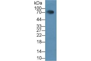 Detection of HCAM in Rat Serum using Polyclonal Antibody to Homing Associated Cell Adhesion Molecule (HCAM) (HCAM 抗体  (AA 24-182))