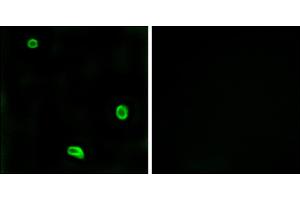 Immunofluorescence analysis of LOVO cells, using R4 antibody. (F2RL3 抗体)
