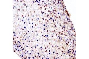 Immunohistochemistry (IHC) image for anti-Fibroblast Growth Factor Receptor 1 (FGFR1) (AA 756-784) antibody (ABIN3028659)