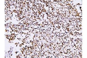 IHC analysis of PHF21A using anti-PHF21A antibody (ABIN6719353). (PHF21A 抗体  (AA 1-97))