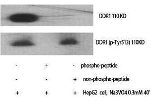 Western Blotting (WB) image for anti-Discoidin Domain Receptor tyrosine Kinase 1 (DDR1) (pTyr513) antibody (ABIN3173324) (DDR1 抗体  (pTyr513))