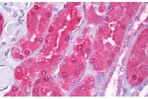 Anti-HIP1 antibody IHC staining of human kidney, tubules. (HIP1 抗体  (AA 928-1038))