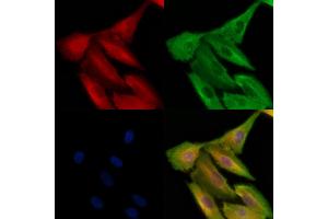 anti-Salt-Inducible Kinase 2 (SIK2) (pSer343) antibody