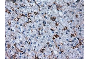 Immunohistochemical staining of paraffin-embedded liver tissue using anti-RPA2 mouse monoclonal antibody. (RPA2 抗体)