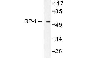 Image no. 1 for anti-Transcription Factor Dp-1 (TFDP1) antibody (ABIN265387) (DP1 抗体)