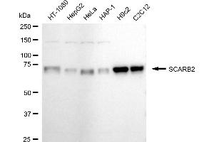 Western blotting analysis using SCARB2 antibody (ABIN7800277).