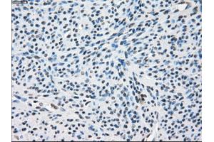 Immunohistochemistry (IHC) image for anti-Zinc Finger Protein 36, C3H Type, Homolog (Mouse) (ZFP36) antibody (ABIN2734315)