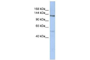 CHSY2 antibody used at 1 ug/ml to detect target protein. (CHPF 抗体  (N-Term))