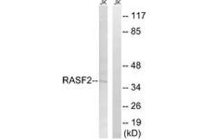Western Blotting (WB) image for anti-Ras Association (RalGDS/AF-6) Domain Family Member 2 (RASSF2) (AA 109-158) antibody (ABIN2890568) (RASSF2 抗体  (AA 109-158))