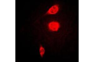 Immunofluorescent analysis of ATF1 staining in KNRK cells. (AFT1 抗体  (C-Term))