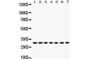 Anti- NQO1 Picoband antibody, Western blotting All lanes: Anti NQO1  at 0. (NQO1 抗体  (C-Term))