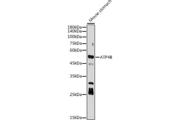 ATP4b 抗体