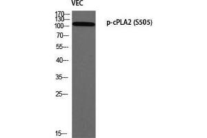 Western Blot (WB) analysis of VEC using p-cPLA2 (S505) antibody. (PLA2G4A 抗体  (pSer505))