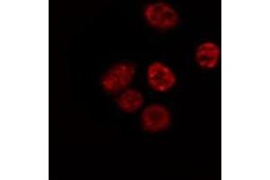 ABIN6267564 staining Hela by IF/ICC. (Histone H4 抗体  (acLys5))