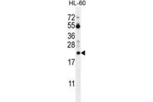 Western blot analysis in HL-60 cell line lysates (35ug/lane) using Prothymosin alpha Antibody (N-term). (PTMA 抗体  (N-Term))