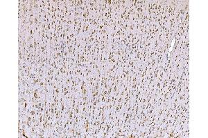 IHC analysis of SND1 using anti-SND1 antibody (ABIN7600526). (SND1 抗体  (AA 20-204))