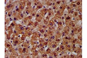 Immunohistochemistry (IHC) image for anti-Carbamoyl-Phosphate Synthase 1, Mitochondrial (CPS1) (AA 1361-1500) antibody (ABIN7146668)