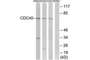 Western blot analysis of extracts from K562/COLO/HuvEc cells, using CDC40 Antibody. (CDC40 抗体  (AA 179-228))