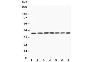 Western blot testing of MEK3 antibody and Lane 1:  rat skeletal muscle
