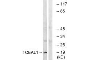 Western blot analysis of extracts from COLO cells, using TCEAL1 Antibody. (TCEAL1 抗体  (AA 91-140))
