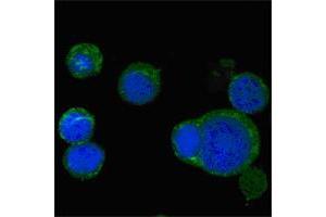 Immunofluorescence (IF) image for anti-Wingless-Type MMTV Integration Site Family, Member 5A (WNT5A) antibody (ABIN969460)
