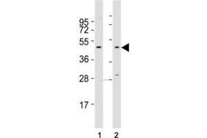 Western blot testing of CCR1 antibody at 1:2000 dilution. (CCR1 抗体  (AA 13-44))