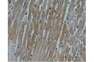 Rat heart tissue was stained by Anti-Adipo R1 (357-375) (Human) Antiserum (Adiponectin Receptor 1 抗体  (AA 357-375))