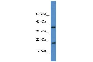 WB Suggested Anti-WBP5 Antibody Titration: 0. (WW Domain Binding Protein 5 (WBP5) (Middle Region) 抗体)