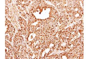 IHC-P Image Immunohistochemical analysis of paraffin-embedded NCI-N87 xenograft, using DECR1, antibody at 1:500 dilution. (DECR1 抗体)