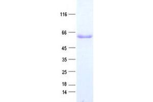 Validation with Western Blot (TBL1X Protein (His tag))