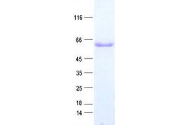 TBL1X Protein (His tag)