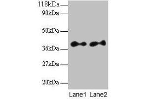 Western blot All lanes: SCAMP3 antibody at 2 μg/mL Lane 1: EC109 whole cell lysate Lane 2: 293T whole cell lysate Secondary Goat polyclonal to rabbit IgG at 1/15000 dilution Predicted band size: 39, 36 kDa Observed band size: 39 kDa (SCAMP3 抗体  (AA 2-170))